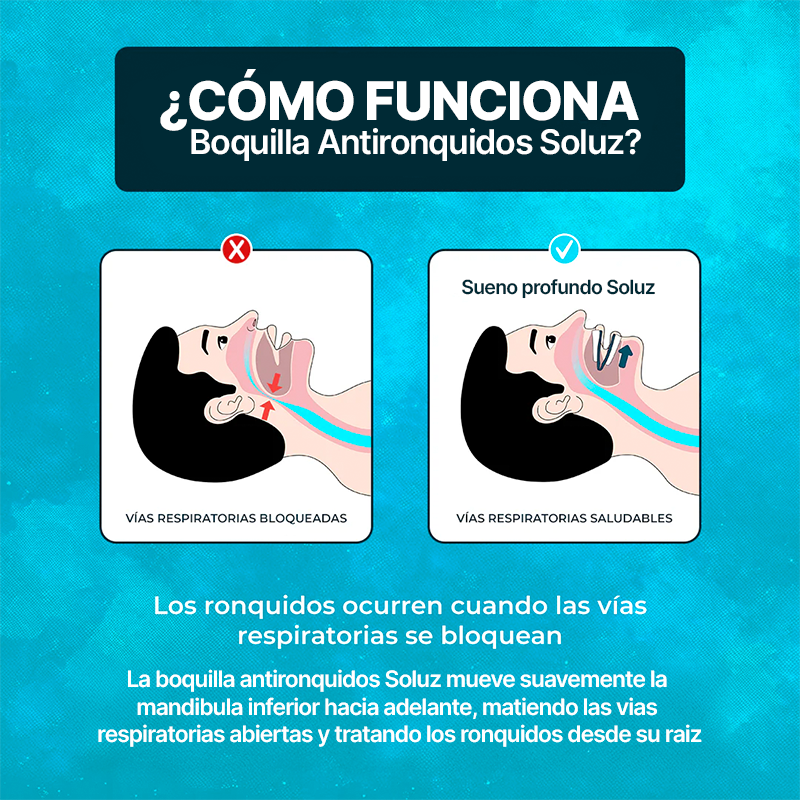 Boquilla Anti-Ronquido Aurelius™ - A solución para volver a dormir juntos - (Talla Universal)
